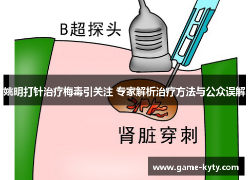 姚明打针治疗梅毒引关注 专家解析治疗方法与公众误解